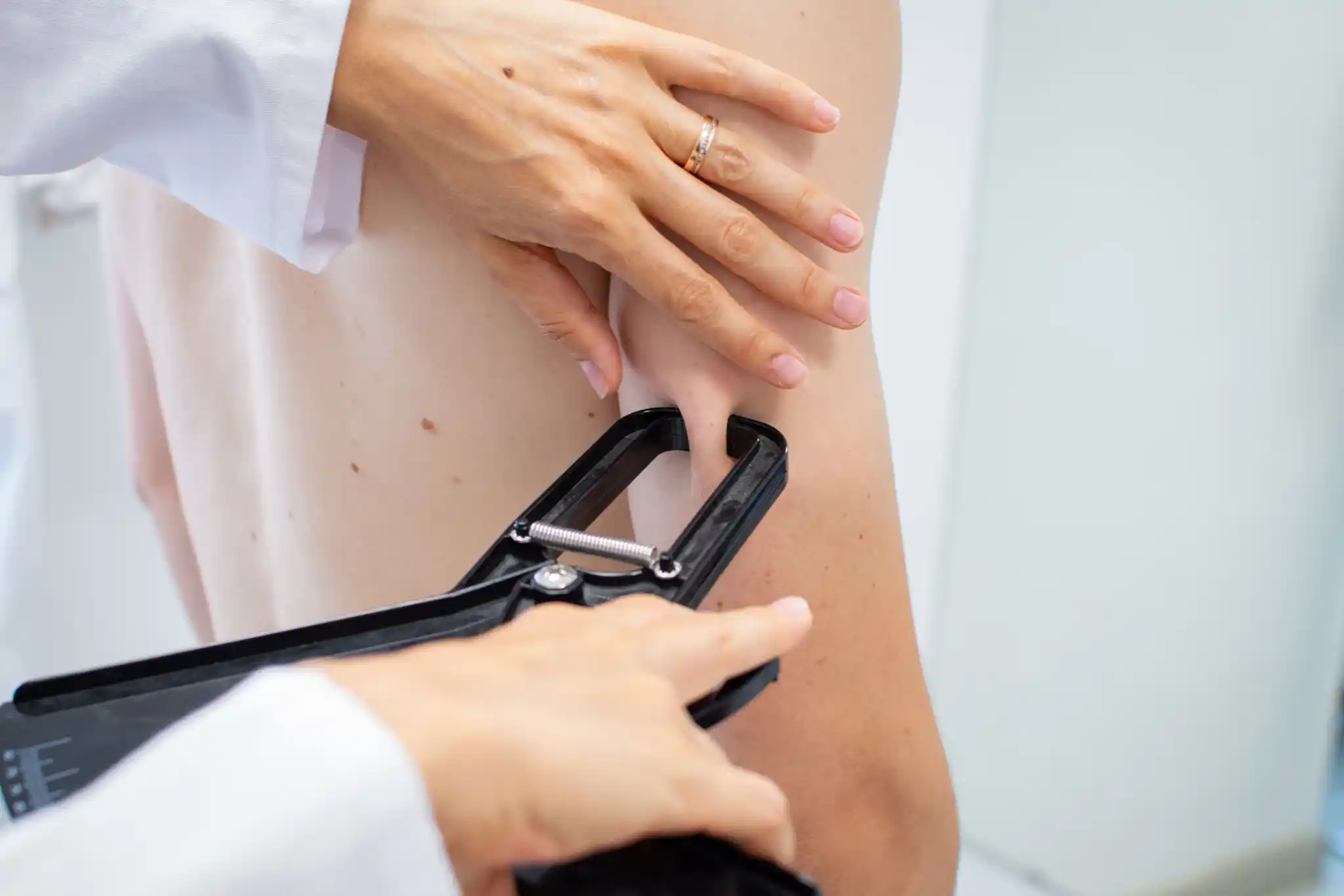 programa perdida de grasa